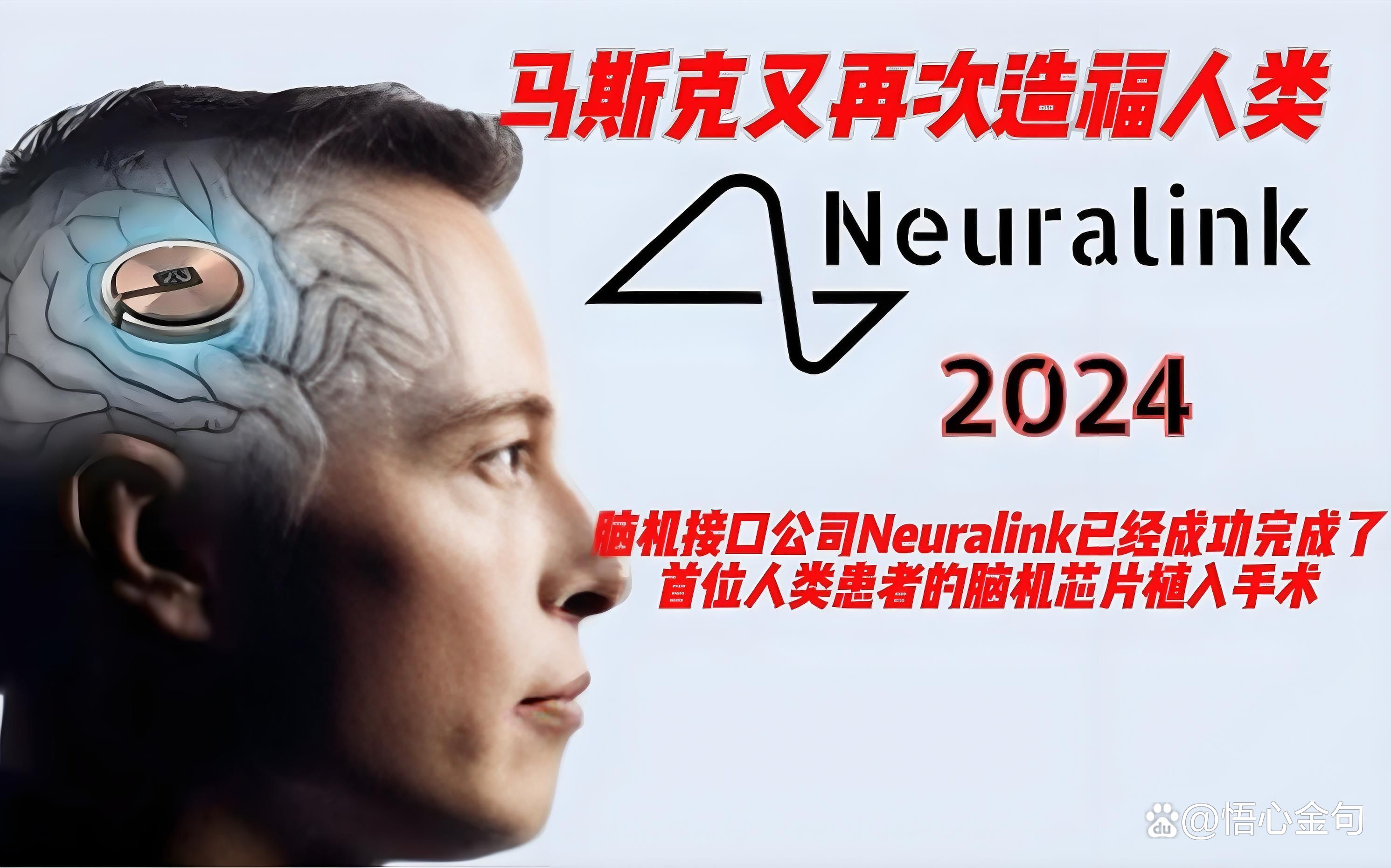 脑机接口产业获力挺 上市公司透露新进展